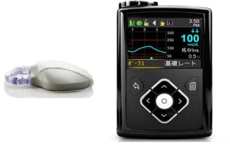 インスリンポンプ