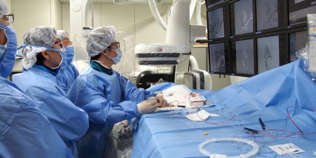 脳血管内治療　脳卒中センター