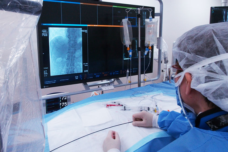 脳血管内治療の様子　GE社製 Innova IGS 630